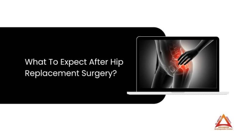 Hip Replacement Recovery Time 70 Year Old Best Joint Replacement Surgeon In Pune Maharashtra 7683