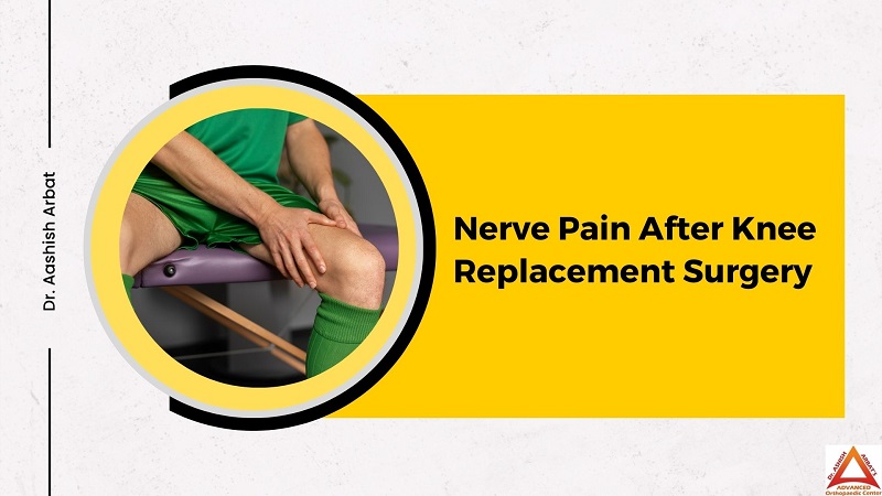 Nerve Pain After Knee Replacement Surgery