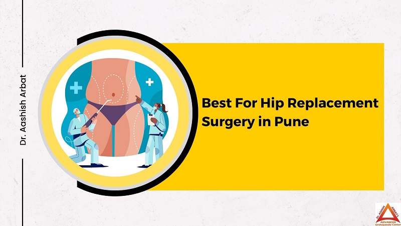 Hip Replacement Surgery in Pune