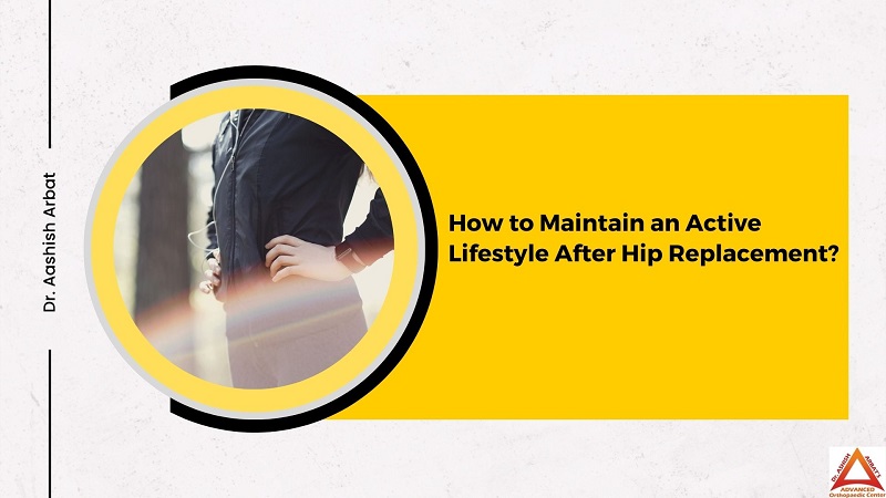 How to Maintain an Active Lifestyle After Hip Replacement