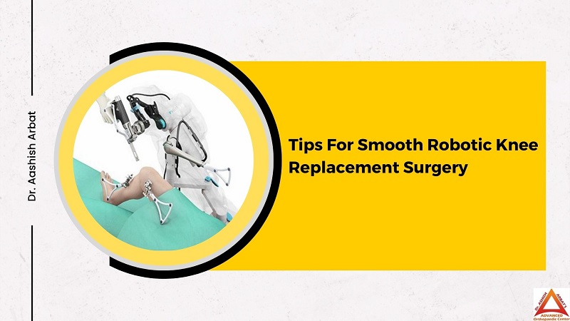 Tips For Smooth Robotic Knee Replacement Surgery