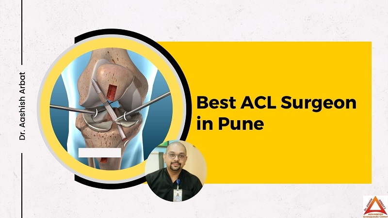 ACL Surgeon in Pune