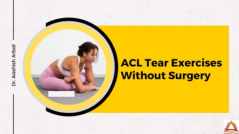 ACL Tear Exercises Without Surgery